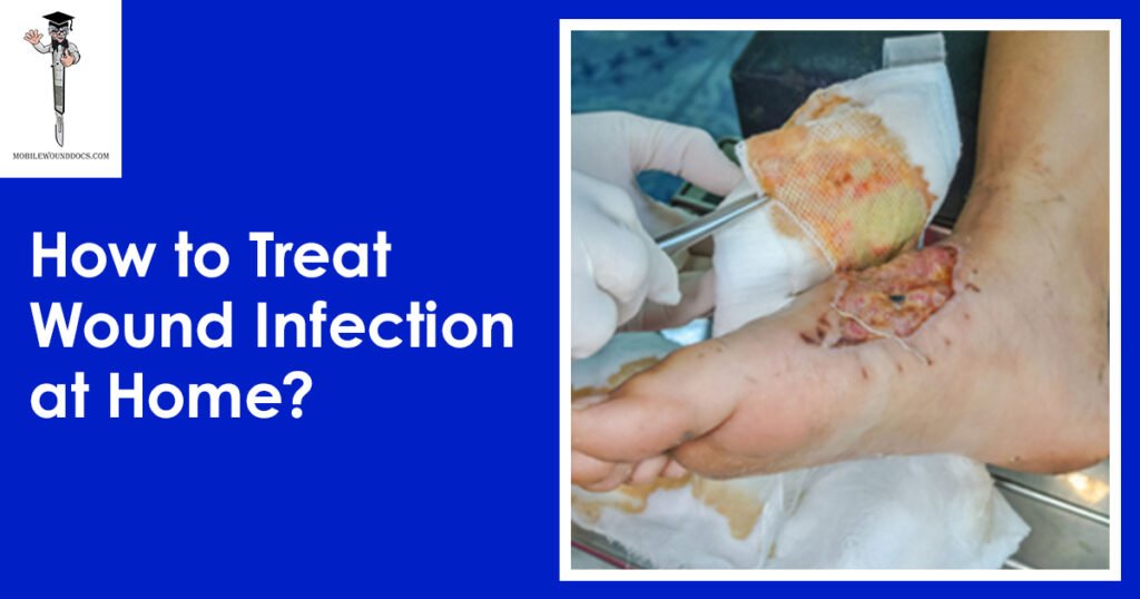 How to Treat Wound Infection at Home_